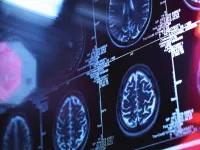 brain scans